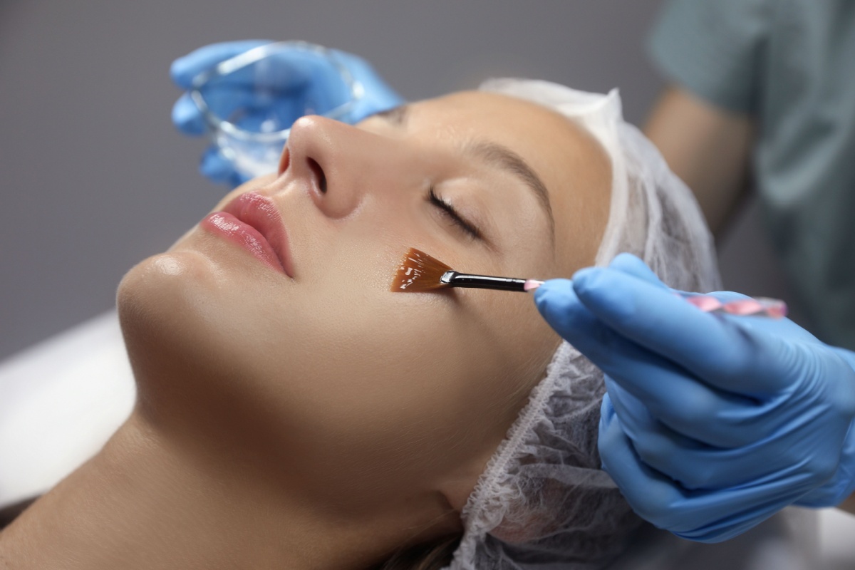 Woman lying down receiving chemical peel facial treatment application by aesthetician wearing blue gloves in clinical setting.