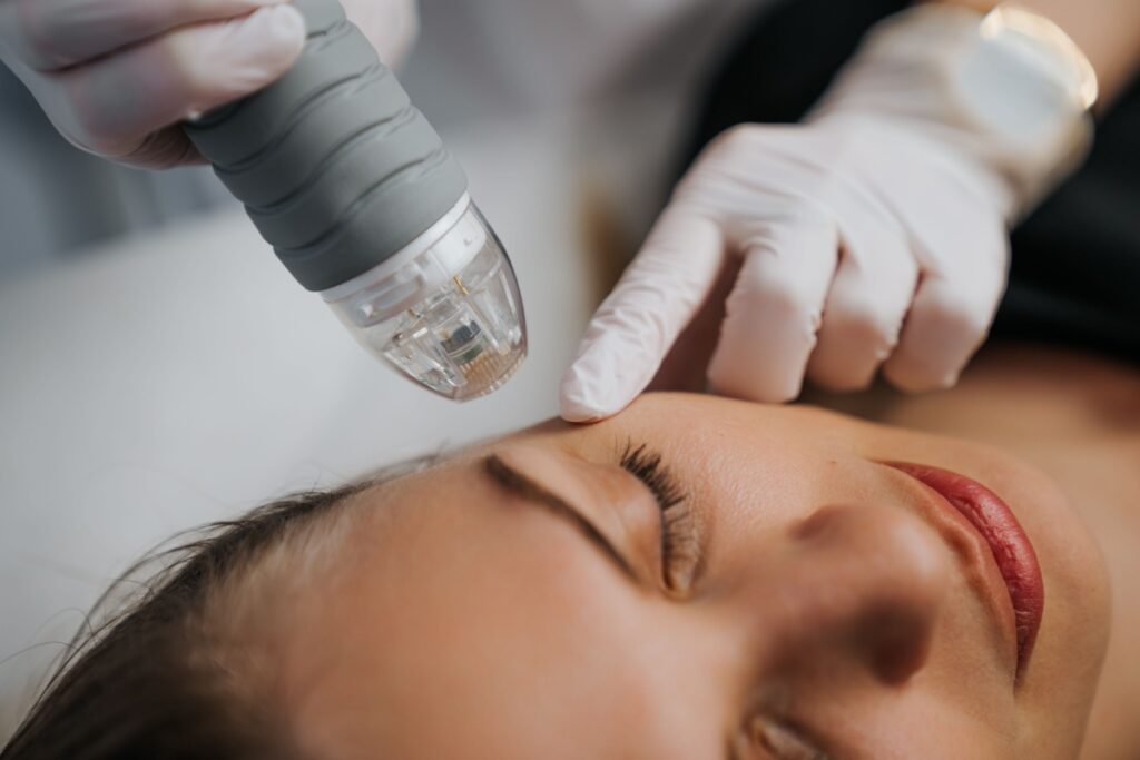 Technician inspecting woman's left eye area before applying RF microneedling.